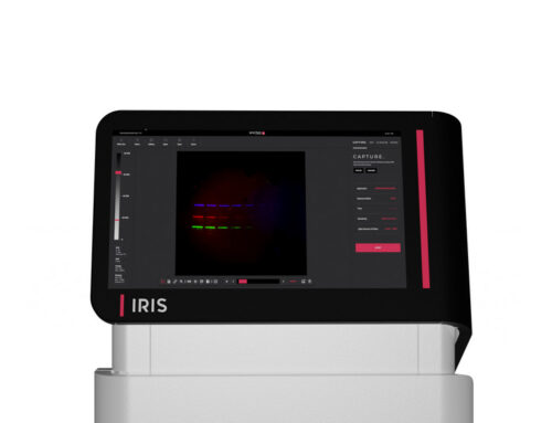 세포 신호 전달 연구의 마침표, 왜 결국 UVITEC Alliance IRIS인가?